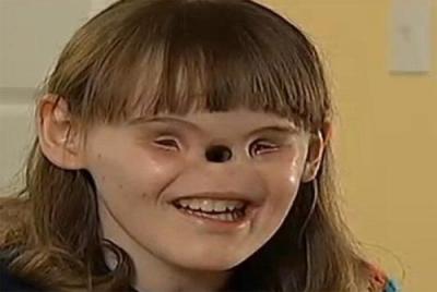 - Ýí ÚãáíÉ äÇÏÑÉ ãä ÇáãäÊÙÑ Ãä ÊÎØÝ ÃäÙÇÑ ÇáÚÇáã¡ ÊÓÊÚÏ ÝÊÇÉ ÃãíÑßíÉ ÊÈáÛ ãä ÇáÚãÑ 16 ÚÇãÇð¡ æáÏÊ ÈÏæä ÃÚíä æÃäÝ¡ Ãä ÊÎÖÚ áÂÎÑ ÚãáíÉ ÓæÝ ÊãäÍåÇ ÃäÝÇð ÝÚáíÇ ÊÓÊØíÚ ãä ÎáÇáå ÇÎÊÈÇÑ ÍÇÓÉ ÇáÔã ÇáØÈíÚíÉ áÃæá ãÑÉ.
